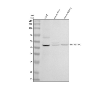 Western blot analysis of TNFRSF10D using anti-TNFRSF10D antibody. Electrophoresis was performed on a 10% SDS-PAGE gel at 80V (Stacking gel) / 120V (Resolving gel) for 2 hours. Lane 1: human whole cell lysates, Lane 2: mouse liver tissue lysates, Lane 3: mouse kidney tissue lysates. After electrophoresis, proteins were transferred to a nitrocellulose membrane at 150 mA for 50-90 minutes. Blocked the membrane with 5% non-fat milk/TBS for 1.5 hour at RT. The membrane was incubated with rabbit anti-TNFRSF10D antibody at 0.5 ug/ml overnight at 4oC, then washed with TBS-0.1%Tween 3 times with 5 minutes each and probed with a goat anti-rabbit IgG-HRP secondary antibody at a dilution of 1:5000 for 1.5 hour at RT. The signal was developed using an ECL Plus Western Blotting Substrate. The expected molecular weight of TNFRSF10D is ~42 kDa.