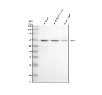DMPK Antibody Heart and Skeletal Muscle WB. Western blot analysis of DMPK using anti-DMPK antibody demonstrates a distinct immunoreactive band at approximately 69 kDa in rat heart, rat skeletal muscle, and mouse heart tissue lysates, consistent with the expected molecular weight of Dystrophia Myotonica Protein Kinase (DMPK). DMPK is a muscle signaling protein involved in regulation of muscle cell architecture, intracellular communication, and maintenance of normal skeletal and cardiac muscle function. The observed expression pattern in both cardiac and skeletal muscle tissues is consistent with the established biologic distribution of DMPK and supports the utility of this antibody for investigating muscle signaling pathways, myotonic dystrophy-associated mechanisms, and muscle physiology research. Western blot was performed using 0.5 ug/ml primary antibody. Predicted molecular weight: ~69 kDa.
