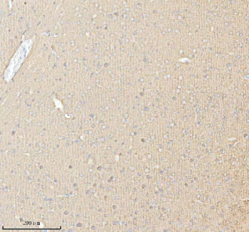 Immunohistochemical staining of PACSIN1 using anti-PACSIN1 antibody. PACSIN1 was detected in a paraffin-embedded section of mouse brain tissue. Heat mediated antigen retrieval was performed in EDTA buffer (pH 8.0, epitope retrieval solution). The tissue section was blocked with 10% goat serum. The tissue section was then incubated with 2 ug/ml rabbit anti-PACSIN1 antibody overnight at 4oC. Peroxidase Conjugated Goat Anti-rabbit IgG was used as secondary antibody and incubated for 30 minutes at 37oC. The tissue section was developed using an HRP secondary and DAB substrate.