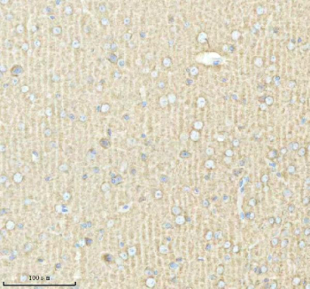 Immunohistochemical staining of PACSIN1 using anti-PACSIN1 antibody. PACSIN1 was detected in a paraffin-embedded section of mouse brain tissue. Heat mediated antigen retrieval was performed in EDTA buffer (pH 8.0, epitope retrieval solution). The tissue section was blocked with 10% goat serum. The tissue section was then incubated with 2 ug/ml rabbit anti-PACSIN1 antibody overnight at 4oC. Peroxidase Conjugated Goat Anti-rabbit IgG was used as secondary antibody and incubated for 30 minutes at 37oC. The tissue section was developed using an HRP secondary and DAB substrate.