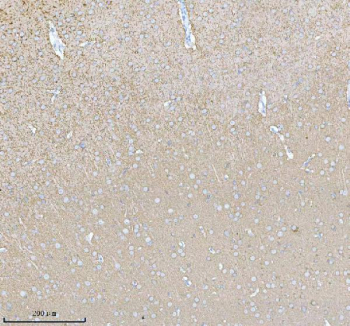 Immunohistochemical staining of PACSIN1 using anti-PACSIN1 antibody. PACSIN1 was detected in a paraffin-embedded section of rat brain tissue. Heat mediated antigen retrieval was performed in EDTA buffer (pH 8.0, epitope retrieval solution). The tissue section was blocked with 10% goat serum. The tissue section was then incubated with 2 ug/ml rabbit anti-PACSIN1 antibody overnight at 4oC. Peroxidase Conjugated Goat Anti-rabbit IgG was used as secondary antibody and incubated for 30 minutes at 37oC. The tissue section was developed using an HRP secondary and DAB substrate.
