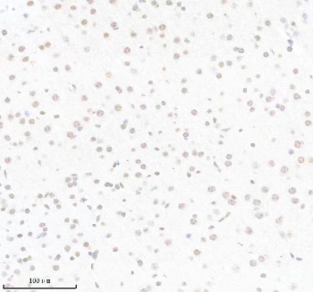 Immunohistochemical staining of PIK3CB using anti- PIK3CB antibody. PIK3CB was detected in a paraffin-embedded section of mouse brain tissue. Heat mediated antigen retrieval was performed in EDTA buffer (pH 8.0, epitope retrieval solution). The tissue section was blocked with 10% goat serum. The tissue section was then incubated with 1: 50 rabbit anti- PIK3CB antibody overnight at 4oC. Peroxidase Conjugated Goat Anti-rabbit IgG was used as secondary antibody and incubated for 30 minutes at 37oC. The tissue section was developed using an HRP secondary and DAB substrate.