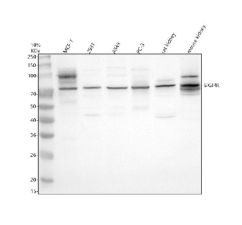 Western blot analysis of SIGIRR using anti-SIGIRR antibody. Electrophoresis was performed on a 10% SDS-PAGE gel at 80V (Stacking gel) / 120V (Resolving gel) for 2 hours. Lane 1: human MCF-7 whole cell lysates, Lane 2: human 293T whole cell lysates, Lane 3: human whole cell lysates, Lane 4: human PC-3 whole cell lysates, Lane 5: rat kidney tissue lysates, Lane 6: mouse kidney tissue lysates. After electrophoresis, proteins were transferred to a nitrocellulose membrane at 150 mA for 50-90 minutes. Blocked the membrane with 5% non-fat milk/TBS for 1.5 hour at RT. The membrane was incubated with rabbit anti-SIGIRR antibody at 0.5 ug/ml overnight at 4oC, then washed with TBS-0.1%Tween 3 times with 5 minutes each and probed with a goat anti-rabbit IgG-HRP secondary antibody at a dilution of 1:5000 for 1.5 hour at RT. The signal was developed using an ECL Plus Western Blotting Substrate. SIGIRR (predicted ~46 kDa) was detected as bands at ~75 kDa and ~90 kDa in lysates, consistent with the extensively N-glycosylated mature receptor forms reported in the literature.