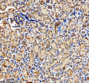 Immunohistochemical staining of SIGIRR using anti-SIGIRR antibody. SIGIRR was detected in a paraffin-embedded section of mouse kidney tissue. Heat mediated antigen retrieval was performed in EDTA buffer (pH 8.0, epitope retrieval solution). The tissue section was blocked with 10% goat serum. The tissue section was then incubated with 2 ug/ml rabbit anti-SIGIRR antibody overnight at 4oC. Peroxidase Conjugated Goat Anti-rabbit IgG was used as secondary antibody and incubated for 30 minutes at 37oC. The tissue section was developed using an HRP secondary and DAB substrate.