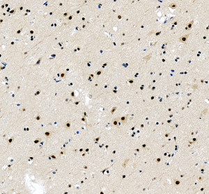 PRDM6 Antibody by IHC in human cerebral cortex. Immunohistochemistry of FFPE human cerebral cortex using PRDM6 Antibody at 2 ug/ml. Brown DAB immunoreactivity is visible in scattered cells throughout the tissue, with staining associated with neuronal cell bodies and surrounding structures. Hematoxylin counterstaining highlights blue nuclei. Heat-mediated antigen retrieval was performed using EDTA buffer (pH 8.0), followed by overnight primary antibody incubation at 4oC. This antibody detects PR domain zinc finger protein 6, a transcriptional regulator involved in chromatin modification and gene expression.