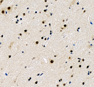 PRDM6 Antibody by IHC in human cerebral cortex at higher magnification. Immunohistochemistry of FFPE human cerebral cortex using PRDM6 Antibody at 2 ug/ml. This field shows scattered brown immunoreactivity in cells with neuronal morphology, including prominent staining in several cell bodies. Smaller surrounding cells exhibit variable staining, while hematoxylin counterstaining identifies blue nuclei. Antigen retrieval was performed using EDTA buffer (pH 8.0), followed by overnight incubation at 4oC. The staining demonstrates immunoreactivity for PR domain zinc finger protein 6 within human cerebral cortex tissue.