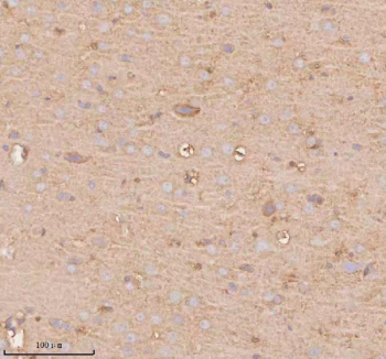 Immunohistochemical staining of SLC14A1 using anti-SLC14A1 antibody. SLC14A1 was detected in a paraffin-embedded section of rat brain tissue. Heat mediated antigen retrieval was performed in EDTA buffer (pH 8.0, epitope retrieval solution). The tissue section was blocked with 10% goat serum. The tissue section was then incubated with 2 ug/ml rabbit anti-SLC14A1 antibody overnight at 4oC. Peroxidase Conjugated Goat Anti-rabbit IgG was used as secondary antibody and incubated for 30 minutes at 37oC. The tissue section was developed using an HRP secondary and DAB substrate.