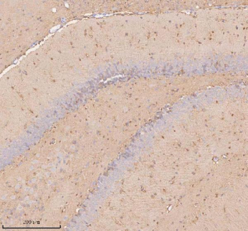 Immunohistochemical staining of SLC14A1 using anti-SLC14A1 antibody. SLC14A1 was detected in a paraffin-embedded section of rat brain tissue. Heat mediated antigen retrieval was performed in EDTA buffer (pH 8.0, epitope retrieval solution). The tissue section was blocked with 10% goat serum. The tissue section was then incubated with 2 ug/ml rabbit anti-SLC14A1 antibody overnight at 4oC. Peroxidase Conjugated Goat Anti-rabbit IgG was used as secondary antibody and incubated for 30 minutes at 37oC. The tissue section was developed using an HRP secondary and DAB substrate.