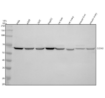 Western blot analysis of SESN3 using anti-SESN3 antibody. Electrophoresis was performed on a 10% SDS-PAGE gel at 80V (Stacking gel) / 120V (Resolving gel) for 2 hours. Lane 1: human Hela whole cell lysates, Lane 2: human whole cell lysates, Lane 3: human 293T whole cell lysates, Lane 4: human HepG2 whole cell lysates, Lane 5: rat liver tissue lysates, Lane 6: rat ovary tissue lysates, Lane 7: mouse liver tissue lysates, Lane 8: mouse ovary tissue lysates. After electrophoresis, proteins were transferred to a nitrocellulose membrane at 150 mA for 50-90 minutes. Blocked the membrane with 5% non-fat milk/TBS for 1.5 hour at RT. The membrane was incubated with rabbit anti-SESN3 antibody at 0.5 ug/ml overnight at 4oC, then washed with TBS-0.1%Tween 3 times with 5 minutes each and probed with a goat anti-rabbit IgG-HRP secondary antibody at a dilution of 1:5000 for 1.5 hour at RT. The signal was developed using an ECL Plus Western Blotting Substrate. SESN3 (~57 kDa predicted) was detected at ~65 kDa, consistent with the phosphorylated and oxidized forms of Sestrin-3 reported in previous studies.