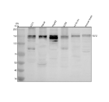 Western blot analysis of SLF2 using anti-SLF2 antibody. Electrophoresis was performed on a 8% SDS-PAGE gel at 80V (Stacking gel) / 120V (Resolving gel) for 2 hours. Lane 1: human U251 whole cell lysates, Lane 2: human Hacat whole cell lysates, Lane 3: human HepG2 whole cell lysates, Lane 4: human U2OS whole cell lysates, Lane 5: rat brain tissue lysates, Lane 6: mouse brain tissue lysates. After electrophoresis, proteins were transferred to a nitrocellulose membrane at 150 mA for 50-90 minutes. Blocked the membrane with 5% non-fat milk/TBS for 1.5 hour at RT. The membrane was incubated with rabbit anti-SLF2 antibody at 0.5 ug/ml overnight at 4oC, then washed with TBS-0.1%Tween 3 times with 5 minutes each and probed with a goat anti-rabbit IgG-HRP secondary antibody at a dilution of 1:5000 for 1.5 hour at RT. The signal was developed using an ECL Plus Western Blotting Substrate. SLF2 (~132 kDa predicted) was detected as a doublet near ~150 kDa, consistent with the phosphorylated and isoform-specific forms reported in the DNA damage response literature.
