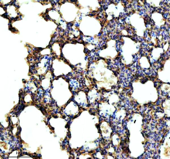 Immunohistochemical staining of NEK5 using anti-NEK5 antibody. NEK5 was detected in a paraffin-embedded section of rat lung tissue. Heat mediated antigen retrieval was performed in EDTA buffer (pH 8.0, epitope retrieval solution). The tissue section was blocked with 10% goat serum. The tissue section was then incubated with 2 ug/ml rabbit anti-NEK5 antibody overnight at 4oC. Peroxidase Conjugated Goat Anti-rabbit IgG was used as secondary antibody and incubated for 30 minutes at 37oC. The tissue section was developed using an HRP secondary and DAB substrate.