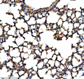 Immunohistochemical staining of NEK5 using anti-NEK5 antibody. NEK5 was detected in a paraffin-embedded section of mouse lung tissue. Heat mediated antigen retrieval was performed in EDTA buffer (pH 8.0, epitope retrieval solution). The tissue section was blocked with 10% goat serum. The tissue section was then incubated with 2 ug/ml rabbit anti-NEK5 antibody overnight at 4oC. Peroxidase Conjugated Goat Anti-rabbit IgG was used as secondary antibody and incubated for 30 minutes at 37oC. The tissue section was developed using an HRP secondary and DAB substrate.