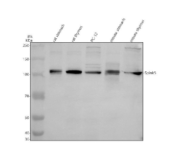 Western blot analysis of Spink5 using anti-Spink5 antibody. Electrophoresis was performed on a 8% SDS-PAGE gel at 80V (Stacking gel) / 120V (Resolving gel) for 2 hours. Lane 1: rat stomach tissue lysates, Lane 2: rat thymus tissue lysates, Lane 3: rat PC-12 whole cell lysates, Lane 4: mouse stomach tissue lysates, Lane 5: mouse thymus tissue lysates. After electrophoresis, proteins were transferred to a nitrocellulose membrane at 150 mA for 50-90 minutes. Blocked the membrane with 5% non-fat milk/TBS for 1.5 hour at RT. The membrane was incubated with rabbit anti-SPINK5 antibody at 0.5 ug/ml overnight at 4oC, then washed with TBS-0.1%Tween 3 times with 5 minutes each and probed with a goat anti-rabbit IgG-HRP secondary antibody at a dilution of 1:5000 for 1.5 hour at RT. The signal was developed using an ECL Plus Western Blotting Substrate. Spink5 (~121 kDa predicted) was detected at ~105 kDa, consistent with the partially processed, glycosylated precursor described in keratinocyte and epithelial studies.