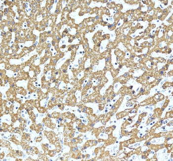 Immunohistochemical staining of SHMT2 using anti-SHMT2 antibody. SHMT2 was detected in a paraffin-embedded section of human liver tissue. Heat mediated antigen retrieval was performed in EDTA buffer (pH 8.0, epitope retrieval solution). The tissue section was blocked with 10% goat serum. The tissue section was then incubated with 2 ug/ml rabbit anti-SHMT2 antibody overnight at 4oC. Peroxidase Conjugated Goat Anti-rabbit IgG was used as secondary antibody and incubated for 30 minutes at 37oC. The tissue section was developed using an HRP secondary and DAB substrate.