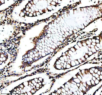 Immunohistochemical staining of SHMT2 using anti-SHMT2 antibody. SHMT2 was detected in a paraffin-embedded section of human colon tissue. Heat mediated antigen retrieval was performed in EDTA buffer (pH 8.0, epitope retrieval solution). The tissue section was blocked with 10% goat serum. The tissue section was then incubated with 2 ug/ml rabbit anti-SHMT2 antibody overnight at 4oC. Peroxidase Conjugated Goat Anti-rabbit IgG was used as secondary antibody and incubated for 30 minutes at 37oC. The tissue section was developed using an HRP secondary and DAB substrate.