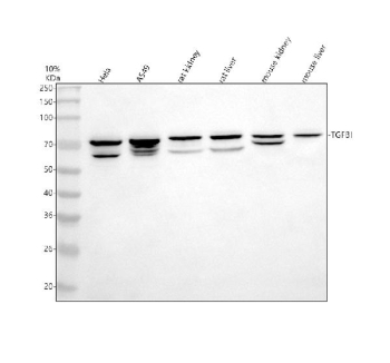 Western blot analysis of TGFBI using anti-TGFBI antibody. Electrophoresis was performed on a 10% SDS-PAGE gel at 80V (Stacking gel) / 120V (Resolving gel) for 2 hours. Lane 1: human Hela whole cell lysates, Lane 2: human whole cell lysates, Lane 3: rat kidney tissue lysates, Lane 4: rat liver tissue lysates, Lane 5: mouse kidney tissue lysates, Lane 6: mouse liver tissue lysates. After electrophoresis, proteins were transferred to a nitrocellulose membrane at 150 mA for 50-90 minutes. Blocked the membrane with 5% non-fat milk/TBS for 1.5 hour at RT. The membrane was incubated with rabbit anti-TGFBI antibody at 0.5 ug/ml overnight at 4oC, then washed with TBS-0.1%Tween 3 times with 5 minutes each and probed with a goat anti-rabbit IgG-HRP secondary antibody at a dilution of 1:5000 for 1.5 hour at RT. The signal was developed using an ECL Plus Western Blotting Substrate. TGFBI (~75 kDa predicted) was detected as a major band at ~75 kDa and a secondary band at ~60-65 kDa, consistent with proteolytic processing of the secreted protein described in previous studies.