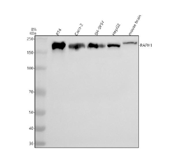 Western blot analysis of RAPH1 using anti-RAPH1 antibody. Electrophoresis was performed on a 8% SDS-PAGE gel at 80V (Stacking gel) / 120V (Resolving gel) for 2 hours. Lane 1: human RT4 whole cell lysates, Lane 2: human Caco-2 whole cell lysates, Lane 3: human SH-SY5Y whole cell lysates, Lane 4: human HepG2 whole cell lysates, Lane 5: mouse brain tissue lysates. After electrophoresis, proteins were transferred to a nitrocellulose membrane at 150 mA for 50-90 minutes. Blocked the membrane with 5% non-fat milk/TBS for 1.5 hour at RT. The membrane was incubated with rabbit anti-RAPH1 antibody at 0.5 ug/ml overnight at 4oC, then washed with TBS-0.1%Tween 3 times with 5 minutes each and probed with a goat anti-rabbit IgG-HRP secondary antibody at a dilution of 1:5000 for 1.5 hour at RT. The signal was developed using an ECL Plus Western Blotting Substrate. RAPH1 (Lamellipodin, ~135 kDa predicted) was detected as a single band at ~150-180 kDa, consistent with its extended proline-rich sequence and post-translational modifications that retard migration on SDS-PAGE.