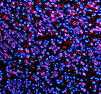 Immunofluorescent staining of TMC6 using anti-TMC6 antibody (red). TMC6 was detected in a paraffin-embedded section of human spleen tissue. Heat mediated antigen retrieval was performed in EDTA buffer (pH 8.0, epitope retrieval solution). The tissue section was blocked with 10% goat serum. The tissue section was then incubated with 5 ug/ml rabbit anti-TMC6 antibody overnight at 4oC. Cy3 Conjugated Goat Anti-Rabbit IgG was used as secondary antibody at 1:500 dilution and incubated for 30 minutes at 37oC. The section was counterstained with DAPI nuclear stain (blue). Visualize using a fluorescence microscope and filter sets appropriate for the label used.
