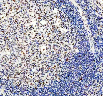 Immunohistochemical staining of TMC6 using anti-TMC6 antibody. TMC6 was detected in a paraffin-embedded section of human tonsil tissue. Heat mediated antigen retrieval was performed in EDTA buffer (pH 8.0, epitope retrieval solution). The tissue section was blocked with 10% goat serum. The tissue section was then incubated with 2 ug/ml rabbit anti-TMC6 antibody overnight at 4oC. Peroxidase Conjugated Goat Anti-rabbit IgG was used as secondary antibody and incubated for 30 minutes at 37oC. The tissue section was developed using an HRP secondary and DAB substrate.