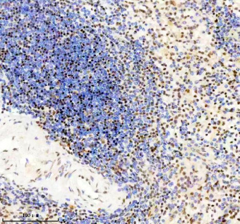 Immunohistochemical staining of TMC6 using anti-TMC6 antibody. TMC6 was detected in a paraffin-embedded section of human spleen tissue. Heat mediated antigen retrieval was performed in EDTA buffer (pH 8.0, epitope retrieval solution). The tissue section was blocked with 10% goat serum. The tissue section was then incubated with 2 ug/ml rabbit anti-TMC6 antibody overnight at 4oC. Peroxidase Conjugated Goat Anti-rabbit IgG was used as secondary antibody and incubated for 30 minutes at 37oC. The tissue section was developed using an HRP secondary and DAB substrate.