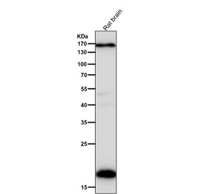 All lanes use the Pleiotrophin antibody at 1:5K dilution for 1 hour at room temperature. Predicted molecular weight ~19 kDa.