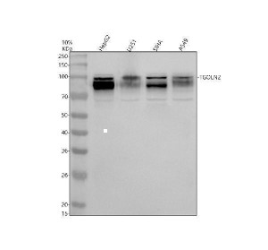TGOLN2 Antibody Human Cancer Cell WB. Western blot analysis of human cancer cell lysates using TGOLN2 Antibody. Lane 1: human HepG2, Lane 2: human U251, Lane 3: human SiHa, Lane 4: human A549 cell lysate. The membrane was incubated with rabbit anti-TGOLN2 antibody at 0.5 ug/ml overnight at 4Â°C, followed by an HRP-conjugated goat anti-rabbit IgG secondary antibody and ECL detection. This TGOLN2 Antibody detects bands at approximately 90-100 kDa, consistent with the reported migration pattern of glycosylated TGN46/TGOLN2 protein, supporting studies of trans-Golgi network organization, protein trafficking, and vesicle transport pathways.