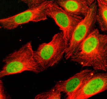 Histone H4 Antibody U2OS IF. Immunofluorescence analysis of human U2OS cells using Histone H4 antibody. Strong nuclear staining (green) is observed, consistent with chromatin-associated localization of Histone H4 and HIST1H4 family proteins within the nucleosome core and higher-order chromatin structure. Beta Tubulin cytoskeletal stain is shown in red, providing cellular architecture contrast to the nuclear histone signal. Nuclei are counterstained blue with DAPI, supporting the expected widespread nuclear distribution pattern of this core chromatin protein.