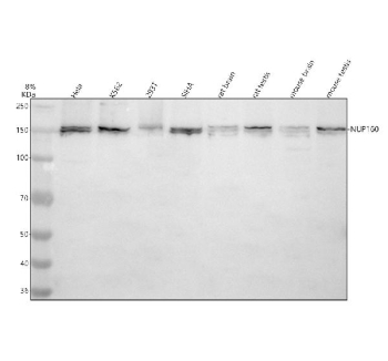 Western blot analysis of NUP160 using anti-NUP160 antibody. Electrophoresis was performed on a 8% SDS-PAGE gel at 80V (Stacking gel) / 120V (Resolving gel) for 2 hours. Lane 1: human Hela whole cell lysates, Lane 2: human K562 whole cell lysates, Lane 3: human 293T whole cell lysates, Lane 4: human SIHA whole cell lysates, Lane 5: rat brain tissue lysates, Lane 6: rat testis tissue lysates, Lane 7: mouse brain tissue lysates, Lane 8: mouse testis tissue lysates. After electrophoresis, proteins were transferred to a nitrocellulose membrane at 150 mA for 50-90 minutes. Blocked the membrane with 5% non-fat milk/TBS for 1.5 hour at RT. The membrane was incubated with rabbit anti-NUP160 antibody at 0.5 ug/ml overnight at 4oC, then washed with TBS-0.1%Tween 3 times with 5 minutes each and probed with a goat anti-rabbit IgG-HRP secondary antibody at a dilution of 1:5000 for 1.5 hour at RT. The signal was developed using an ECL Plus Western Blotting Substrate. NUP160 (~160 kDa predicted) was detected as a doublet near 150â160 kDa, consistent with phosphorylation-dependent mobility shifts and isoform variation described for nucleoporins in the nuclear pore complex.