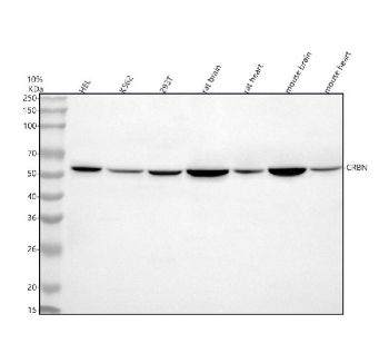 Western blot analysis of CRBN using anti-CRBN antibody. Lane 1: human HEL whole cell lysates, Lane 2: human K562 whole cell lysates, Lane 3: human 293T whole cell lysates, Lane 4: rat brain tissue lysates, Lane 5: rat heart tissue lysates, Lane 6: mouse brain tissue lysates, Lane 7: mouse heart tissue lysates. After electrophoresis, proteins were transferred to a nitrocellulose membrane at 150 mA for 50-90 minutes. Blocked the membrane with 5% non-fat milk/TBS for 1.5 hour at RT. The membrane was incubated with rabbit anti-CRBN antibody at 0.5 ug/ml overnight at 4oC, then washed with TBS-0.1%Tween 3 times with 5 minutes each and probed with a goat anti-rabbit IgG-HRP secondary antibody at a dilution of 1:5000 for 1.5 hour at RT. The signal was developed using enhanced chemiluminescent. The expected molecular weight of CRBN is ~51 kDa.