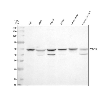 Western blot analysis of PARP15 using anti-PARP15 antibody. Electrophoresis was performed on a 10% SDS-PAGE gel at 80V (Stacking gel) / 120V (Resolving gel) for 2 hours. Lane 1: human Raji whole cell lysates, Lane 2: human whole cell lysates, Lane 3: human HepG2 whole cell lysates, Lane 4: human Jurkat whole cell lysates, Lane 5: rat stomach tissue lysates, Lane 6: mouse stomach tissue lysates. After electrophoresis, proteins were transferred to a nitrocellulose membrane at 150 mA for 50-90 minutes. Blocked the membrane with 5% non-fat milk/TBS for 1.5 hour at RT. The membrane was incubated with rabbit anti-PARP15 antibody at 0.5 ug/ml overnight at 4oC, then washed with TBS-0.1%Tween 3 times with 5 minutes each and probed with a goat anti-rabbit IgG-HRP secondary antibody at a dilution of 1:5000 for 1.5 hour at RT. The signal was developed using an ECL Plus Western Blotting Substrate. PARP15 (~71 kDa predicted) was detected at ~55-60 kDa, consistent with previously described electrophoretic mobility shifts and alternative splicing. A secondary band at ~40 kDa corresponds to a truncated or proteolytically cleaved form encompassing the RNA-binding region.