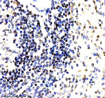 Immunohistochemical staining of PARP15 using anti-PARP15 antibody. PARP15 was detected in a paraffin-embedded section of human spleen tissue. Heat mediated antigen retrieval was performed in EDTA buffer (pH 8.0, epitope retrieval solution). The tissue section was blocked with 10% goat serum. The tissue section was then incubated with 2 ug/ml rabbit anti-PARP15 antibody overnight at 4oC. Peroxidase Conjugated Goat Anti-rabbit IgG was used as secondary antibody and incubated for 30 minutes at 37oC. The tissue section was developed using an HRP secondary and DAB substrate.