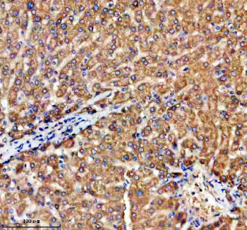 Immunohistochemical staining of TRIM59 using anti-TRIM59 antibody. TRIM59 was detected in a paraffin-embedded section of human liver tissue. Heat mediated antigen retrieval was performed in EDTA buffer (pH 8.0, epitope retrieval solution). The tissue section was blocked with 10% goat serum. The tissue section was then incubated with 2 ug/ml rabbit anti-TRIM59 antibody overnight at 4oC. Peroxidase Conjugated Goat Anti-rabbit IgG was used as secondary antibody and incubated for 30 minutes at 37oC. The tissue section was developed using an HRP secondary and DAB substrate.