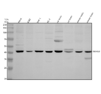 Western blot analysis of TRIM59 using anti-TRIM59 antibody. Electrophoresis was performed on a 10% SDS-PAGE gel at 80V (Stacking gel) / 120V (Resolving gel) for 2 hours. Lane 1: human Hacat whole cell lysates, Lane 2: human K562 whole cell lysates, Lane 3: human THP-1 whole cell lysates, Lane 4: human PC-3 whole cell lysates, Lane 5: rat testis tissue lysates, Lane 6: rat brain tissue lysates, Lane 7: mouse testis tissue lysates, Lane 8: mouse brain tissue lysates. After electrophoresis, proteins were transferred to a nitrocellulose membrane at 150 mA for 50-90 minutes. Blocked the membrane with 5% non-fat milk/TBS for 1.5 hour at RT. The membrane was incubated with rabbit anti-TRIM59 antibody at 0.5 ug/ml overnight at 4oC, then washed with TBS-0.1%Tween 3 times with 5 minutes each and probed with a goat anti-rabbit IgG-HRP secondary antibody at a dilution of 1:5000 for 1.5 hour at RT. The signal was developed using an ECL Plus Western Blotting Substrate. TRIM59 (~53 kDa predicted) was detected at 42-48 kDa, consistent with the known lower electrophoretic mobility of TRIM family proteins and previously reported truncated or compact isoforms.