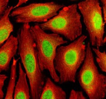 Immunofluorescent staining of TFDP3 using anti-TFDP3 antibody (green) and anti-Beta Tubulin antibody (red). TFDP3 was detected in an immunocytochemical section of U2OS cells. Enzyme antigen retrieval was performed using IHC enzyme antigen retrieval reagent for 15 mins. The cells were blocked with 10% goat serum. And then incubated with 5 ug/ml rabbit anti-TFDP3 antibody and mouse anti-Beta Tubulin antibody overnight at 4oC. DyLight 488 Conjugated Goat Anti-Rabbit IgG and Cy3 Conjugated Goat Anti-Mouse IgG were used as secondary antibody at 1:500 dilution and incubated for 30 minutes at 37oC. Visualize using a fluorescence microscope and filter sets appropriate for the label used.