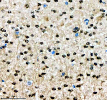 Immunohistochemical staining of SALL2 using anti-SALL2 antibody. SALL2 was detected in a paraffin-embedded section of mouse brain tissue. Heat mediated antigen retrieval was performed in EDTA buffer (pH 8.0, epitope retrieval solution). The tissue section was blocked with 10% goat serum. The tissue section was then incubated with 2 ug/ml rabbit anti-SALL2 antibody overnight at 4oC. Peroxidase Conjugated Goat Anti-rabbit IgG was used as secondary antibody and incubated for 30 minutes at 37oC. The tissue section was developed using an HRP secondary and DAB substrate.