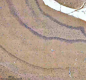 Immunohistochemical staining of SALL2 using anti-SALL2 antibody. SALL2 was detected in a paraffin-embedded section of rat brain tissue. Heat mediated antigen retrieval was performed in EDTA buffer (pH 8.0, epitope retrieval solution). The tissue section was blocked with 10% goat serum. The tissue section was then incubated with 2 ug/ml rabbit anti-SALL2 antibody overnight at 4oC. Peroxidase Conjugated Goat Anti-rabbit IgG was used as secondary antibody and incubated for 30 minutes at 37oC. The tissue section was developed using an HRP secondary and DAB substrate.