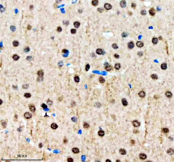 Immunohistochemical staining of SALL2 using anti-SALL2 antibody. SALL2 was detected in a paraffin-embedded section of rat brain tissue. Heat mediated antigen retrieval was performed in EDTA buffer (pH 8.0, epitope retrieval solution). The tissue section was blocked with 10% goat serum. The tissue section was then incubated with 2 ug/ml rabbit anti-SALL2 antibody overnight at 4oC. Peroxidase Conjugated Goat Anti-rabbit IgG was used as secondary antibody and incubated for 30 minutes at 37oC. The tissue section was developed using an HRP secondary and DAB substrate.