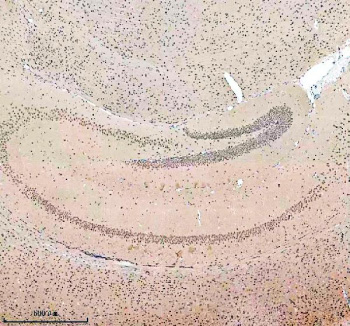 Immunohistochemical staining of SALL2 using anti-SALL2 antibody. SALL2 was detected in a paraffin-embedded section of mouse brain tissue. Heat mediated antigen retrieval was performed in EDTA buffer (pH 8.0, epitope retrieval solution). The tissue section was blocked with 10% goat serum. The tissue section was then incubated with 2 ug/ml rabbit anti-SALL2 antibody overnight at 4oC. Peroxidase Conjugated Goat Anti-rabbit IgG was used as secondary antibody and incubated for 30 minutes at 37oC. The tissue section was developed using an HRP secondary and DAB substrate.