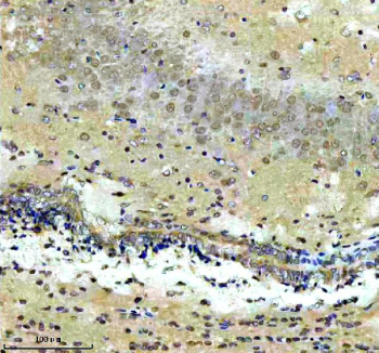 Immunohistochemical staining of CXXC5 using anti-CXXC5 antibody. CXXC5 was detected in a paraffin-embedded section of mouse brain tissue. Heat mediated antigen retrieval was performed in EDTA buffer (pH 8.0, epitope retrieval solution). The tissue section was blocked with 10% goat serum. The tissue section was then incubated with 2 ug/ml rabbit anti-CXXC5 antibody overnight at 4oC. Peroxidase Conjugated Goat Anti-rabbit IgG was used as secondary antibody and incubated for 30 minutes at 37oC. The tissue section was developed using an HRP secondary and DAB substrate.