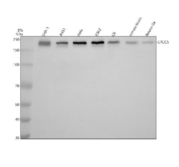 Western blot analysis of ERCC5 using anti-ERCC5 antibody. Electrophoresis was performed on a 8% SDS-PAGE gel at 80V (Stacking gel) / 120V (Resolving gel) for 2 hours. Lane 1: human THP-1 whole cell lysates, Lane 2: human whole cell lysates, Lane 3: human Hela whole cell lysates, Lane 4: human K562 whole cell lysates, Lane 5: rat C6 tissue lysates, Lane 6: mouse brain tissue lysates, Lane 7: mouse Neuro-2a tissue lysates. After electrophoresis, proteins were transferred to a nitrocellulose membrane at 150 mA for 50-90 minutes. Blocked the membrane with 5% non-fat milk/TBS for 1.5 hour at RT. The membrane was incubated with rabbit anti-ERCC5 antibody at 0.5 ug/ml overnight at 4oC, then washed with TBS-0.1%Tween 3 times with 5 minutes each and probed with a goat anti-rabbit IgG-HRP secondary antibody at a dilution of 1:5000 for 1.5 hour at RT. The signal was developed using an ECL Plus Western Blotting Substrate. ERCC5/XPG (~133 kDa predicted) was detected as a doublet at ~200 kDa, consistent with its known anomalous migration caused by the large acidic spacer domain and post-translational modification of XPG.