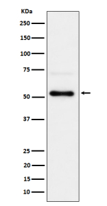 Phospho-CHK1 Antibody 293T WB. Western blot analysis of human 293T cell lysate treated with Calyculin A using phospho-CHK1 antibody detecting CHK1 phosphorylated at Ser280, clone 31C46. A band is observed at approximately 54 kDa, consistent with the predicted molecular weight of CHK1. Detection under phosphatase inhibition conditions supports phosphorylation-dependent regulation of CHK1 and signaling cross-talk with cellular pathways.