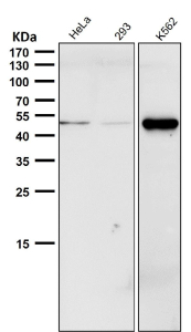 All lanes use the Phospho-CHK1 (pSer280) Antibody at 1:1000 dilution for 1 hour at room temperature.