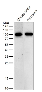 Phospho-Beta Catenin (pThr41/pSer45) Antibody Brain WB. Western blot testing of brain tissue lysate using the Phospho-Beta Catenin (pThr41/pSer45) antibody at 1:1000 dilution for 1 hour at room temperature.