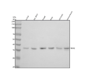 Western blot analysis of REM2 using anti-REM2 antibody. Lane 1: human Jurkat whole cell lysates, Lane 2: human SH-SY5Y whole cell lysates, Lane 3: human Hacat whole cell lysates, Lane 4: human Hela whole cell lysates, Lane 5: rat brain tissue lysates, Lane 6: mouse brain tissue lysates. After electrophoresis, proteins were transferred to a nitrocellulose membrane at 150 mA for 50-90 minutes. Blocked the membrane with 5% non-fat milk/TBS for 1.5 hour at RT. The membrane was incubated with rabbit anti-REM2 antibody at 0.5 ug/ml overnight at 4oC, then washed with TBS-0.1%Tween 3 times with 5 minutes each and probed with a goat anti-rabbit IgG-HRP secondary antibody at a dilution of 1:5000 for 1.5 hour at RT. The signal was developed using enhanced chemiluminescent. The expected molecular weight of REM2 is ~37 kDa.