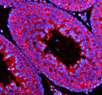 Immunofluorescent staining of STX5 using anti-STX5 antibody (red). STX5 was detected in a paraffin-embedded section of rat testis tissue. Heat mediated antigen retrieval was performed in EDTA buffer (pH 8.0, epitope retrieval solution). The tissue section was blocked with 10% goat serum. The tissue section was then incubated with 5 ug/ml rabbit anti-STX5 antibody overnight at 4oC. Cy3 Conjugated Goat Anti-Rabbit IgG was used as secondary antibody at 1:500 dilution and incubated for 30 minutes at 37oC. The section was counterstained with DAPI nuclear stain (blue). Visualize using a fluorescence microscope and filter sets appropriate for the label used.