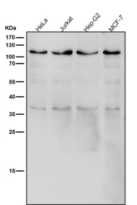 All lanes use the USP5 antibody at 1:1K dilution for 1 hour at room temperature. Predicted molecular weight ~96 kDa.