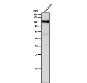 All lanes use the USP5 antibody at 1:1K dilution for 1 hour at room temperature. Predicted molecular weight ~96 kDa.