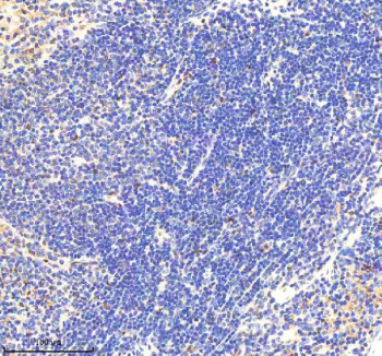 Immunohistochemical staining of RNF111 using anti-RNF111 antibody. RNF111 was detected in a paraffin-embedded section of mouse spleen tissue. Heat mediated antigen retrieval was performed in EDTA buffer (pH 8.0, epitope retrieval solution). The tissue section was blocked with 10% goat serum. The tissue section was then incubated with 2 ug/ml rabbit anti-RNF111 antibody overnight at 4oC. Peroxidase Conjugated Goat Anti-rabbit IgG was used as secondary antibody and incubated for 30 minutes at 37oC. The tissue section was developed using an HRP secondary and DAB substrate.