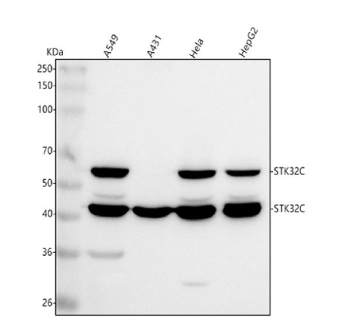 Western blot analysis of STK32C using anti-STK32C antibody. Lane 1: human whole cell lysates, Lane 2: human whole cell lysates, Lane 3: human Hela whole cell lysates, Lane 4: human HepG2 whole cell lysates. After electrophoresis, proteins were transferred to a nitrocellulose membrane at 150 mA for 50-90 minutes. Blocked the membrane with 5% non-fat milk/TBS for 1.5 hour at RT. The membrane was incubated with rabbit anti-STK32C antibody at 0.5 ug/ml overnight at 4oC, then washed with TBS-0.1%Tween 3 times with 5 minutes each and probed with a goat anti-rabbit IgG-HRP secondary antibody at a dilution of 1:5000 for 1.5 hour at RT. The signal was developed using enhanced chemiluminescent. STK32C (~55 kDa predicted) was detected as a major band at ~60 kDa, consistent with the known canonical isoform migrating slightly above its calculated molecular weight, and a minor band at ~43 kDa, which may represent a shorter splice variant or proteolytic fragment of STK32C.