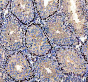 Immunohistochemical staining of PARP11 using anti-PARP11 antibody. PARP11 was detected in a paraffin-embedded section of mouse testis tissue. Heat mediated antigen retrieval was performed in EDTA buffer (pH 8.0, epitope retrieval solution). The tissue section was blocked with 10% goat serum. The tissue section was then incubated with 2 ug/ml rabbit anti-PARP11 antibody overnight at 4oC. Peroxidase Conjugated Goat Anti-rabbit IgG was used as secondary antibody and incubated for 30 minutes at 37oC. The tissue section was developed using an HRP secondary and DAB substrate.